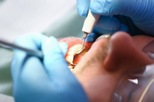 Best Emergency Tooth Extraction in East Valley, NV