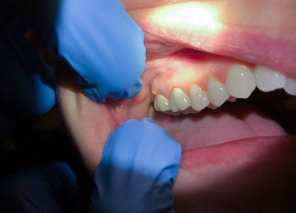 Best Emergency Treatment for Toothache in East Valley, NV